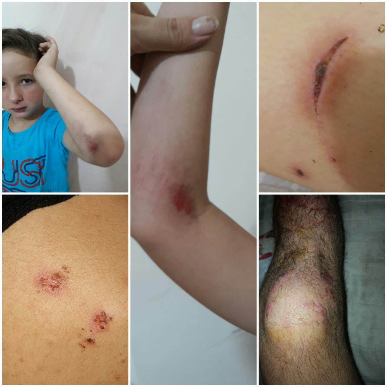 اللاجئ السوري في مواجهة العنف...