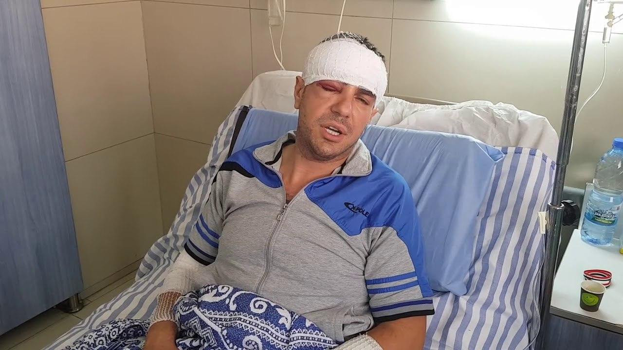 إصابة مراسل تلفزيون النظام ومص...