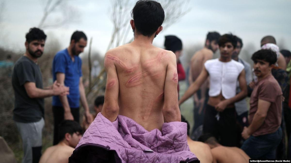 شبكة أمريكية تسلط الضوء على تع...