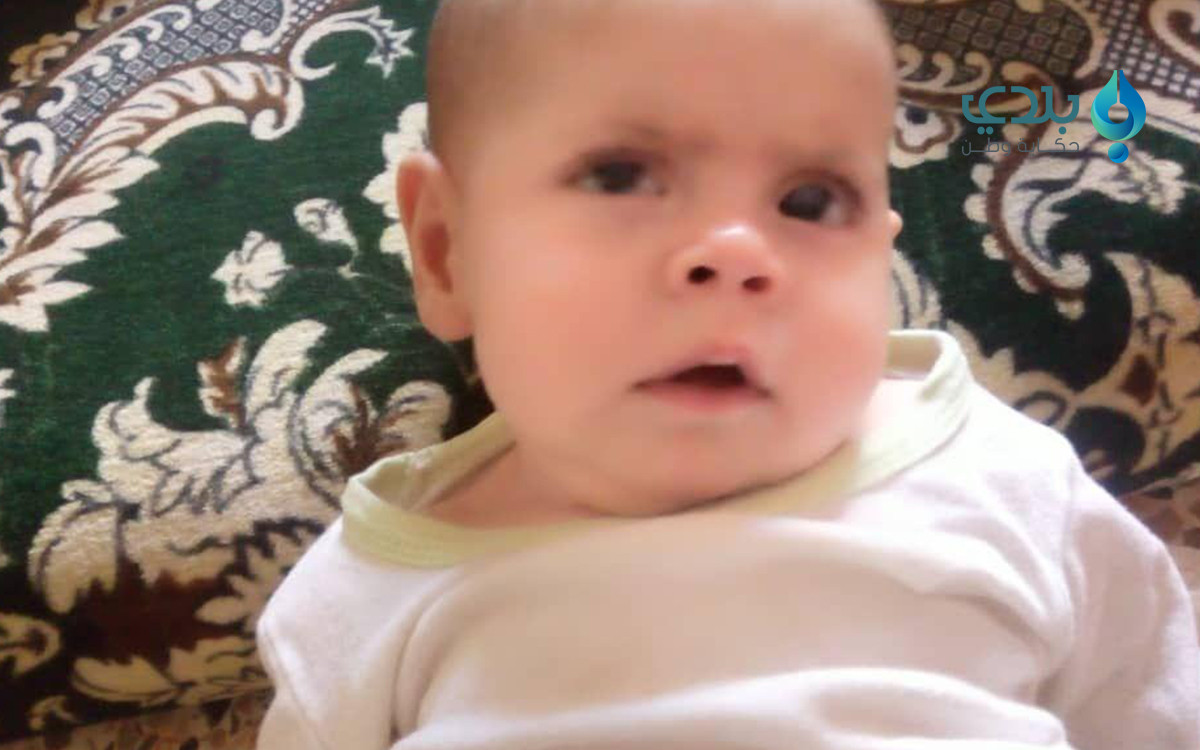 ولدت فاقدة للبصر.. طفلة بريف ح...