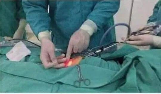 ظاهرة "بيع الخصية" تنتشر في من...