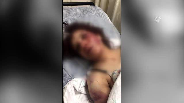 الشرطة التركية توقف سوريا عذب...