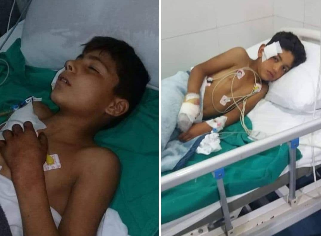 إصابة طفلين بجروح بانفجار لغم...