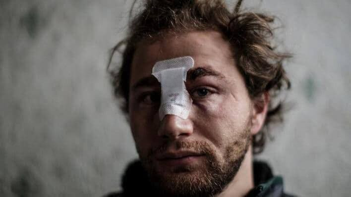 الشرطة الفرنسية تفتح تحقيقا في...