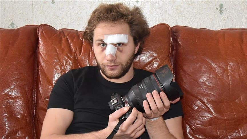 مصور سوري يروي كيف تعرض للضرب...