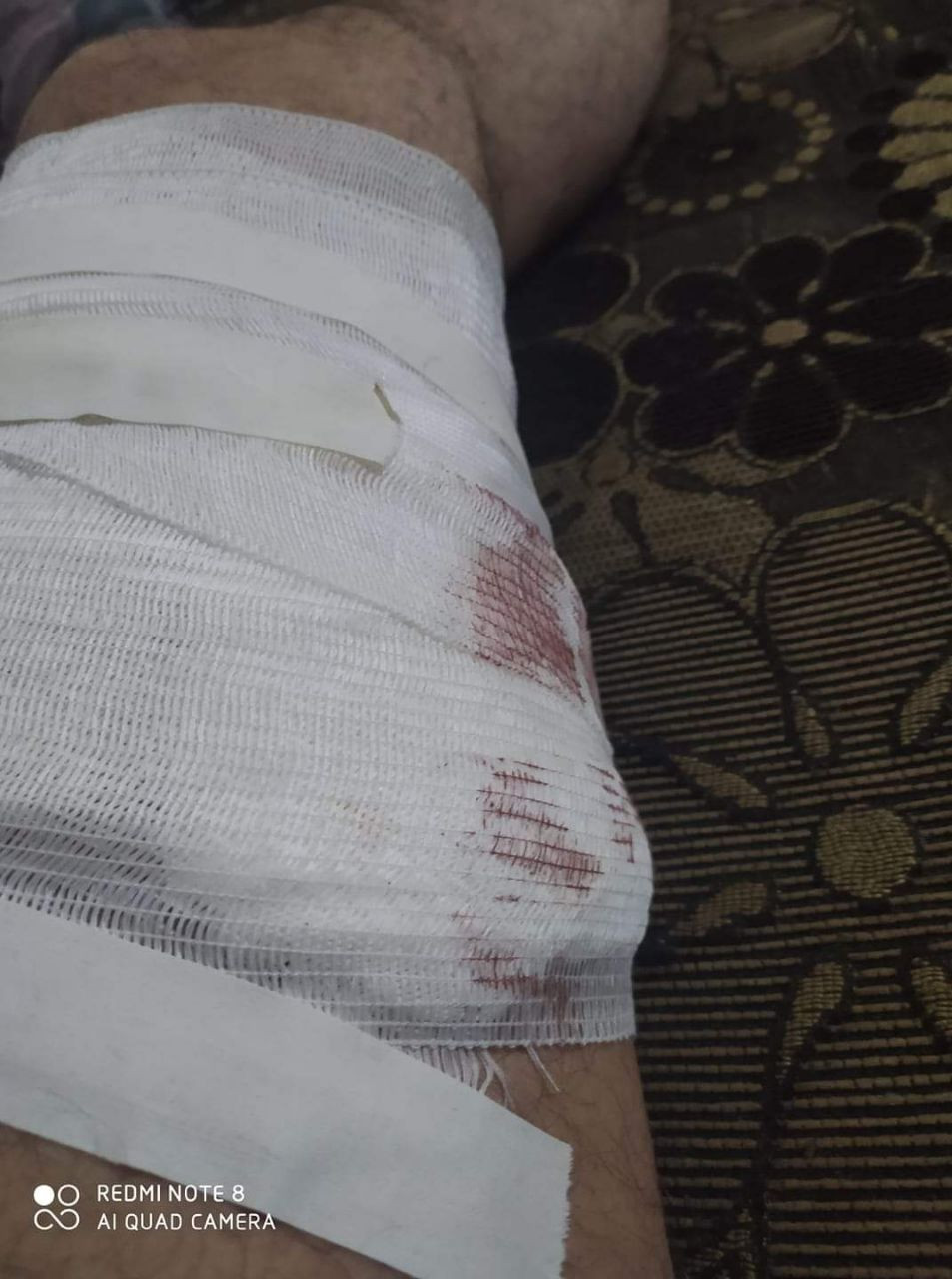 بعد محاولة اغتياله.. مجهولون ي...