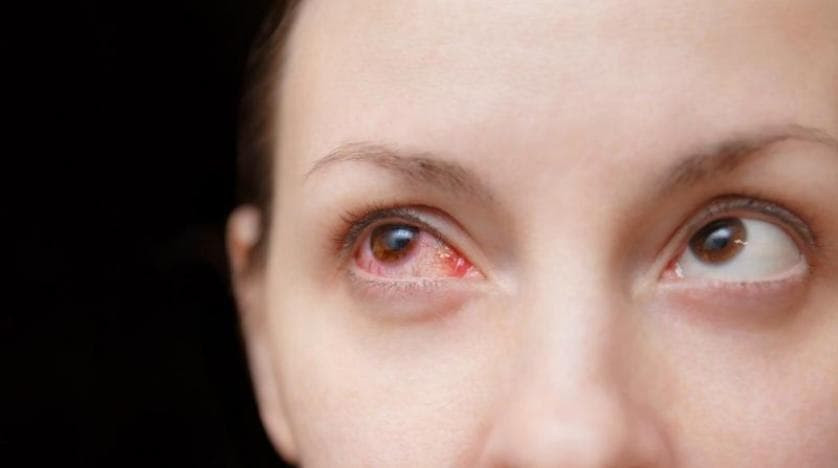 3 أعراض في العين تخبرك بإصابتك...
