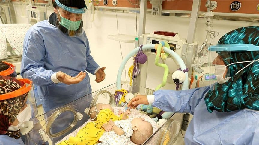 تركيا تلم شمل توأمين ملتصقين س...