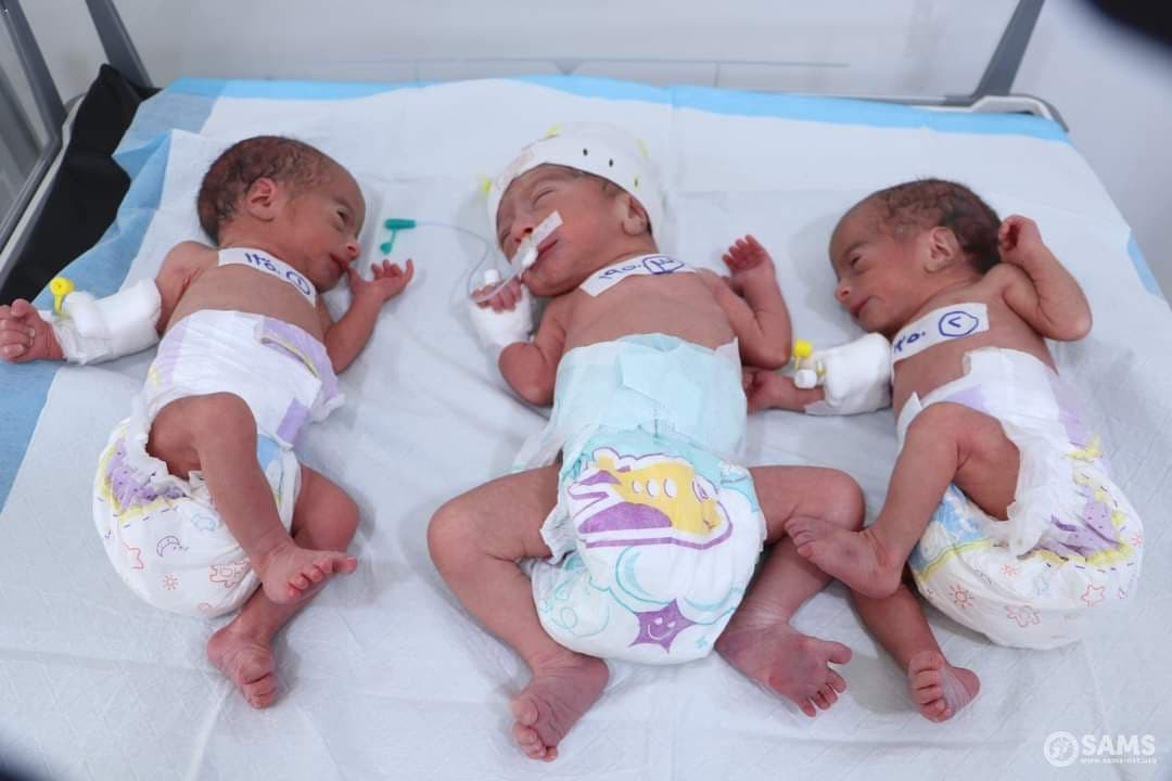 ولادة توأم ثلاثي في إدلب