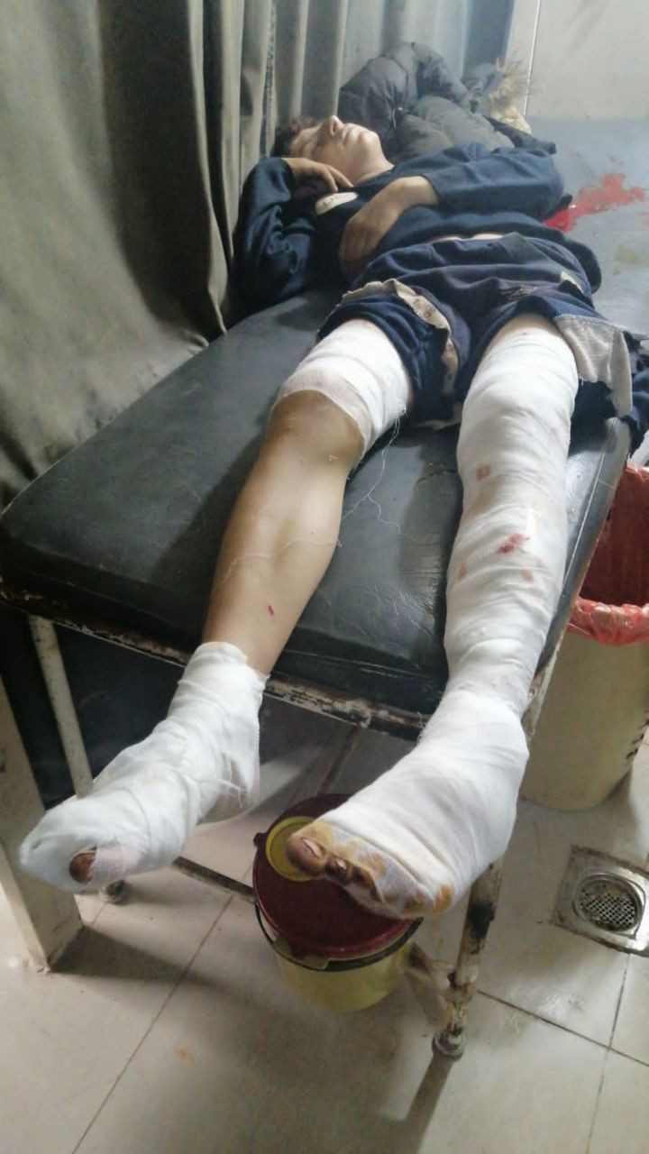 انفجار قنابل عنقودية يخلف ثلاث...