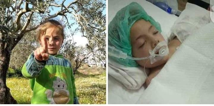 متأثرة بجراحها.. استشهاد طفلة...