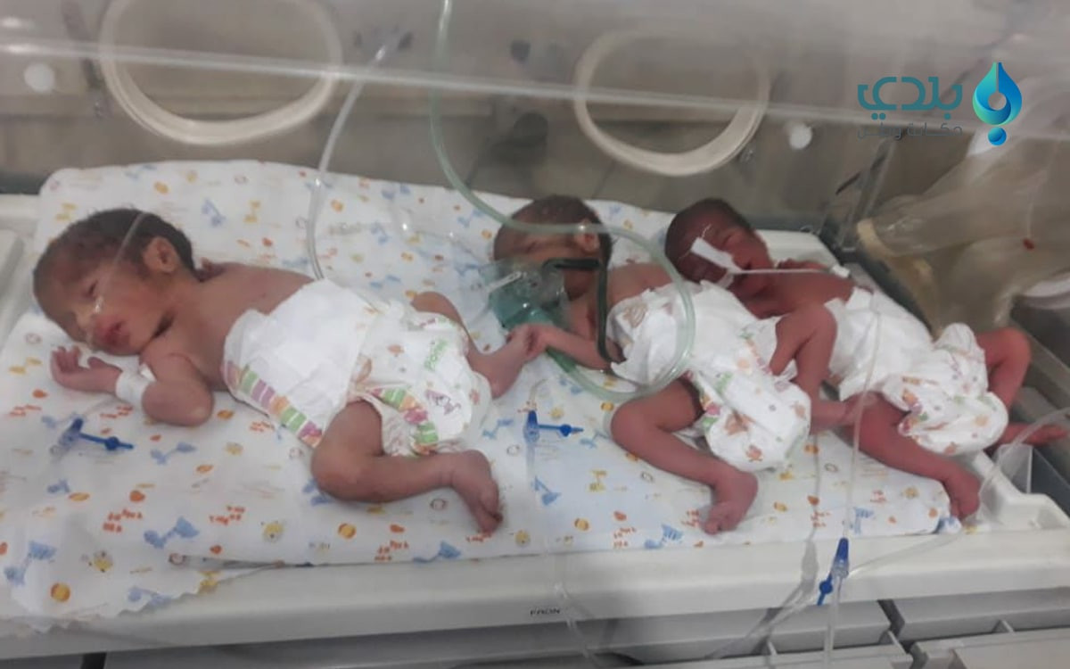 امرأة تنجب ثلاثة توائم ذكور في...