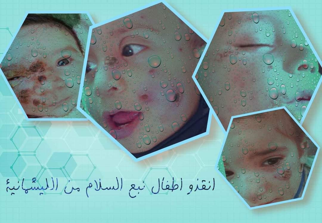 مناشدات لإنقاذ أطفال رأس العين...