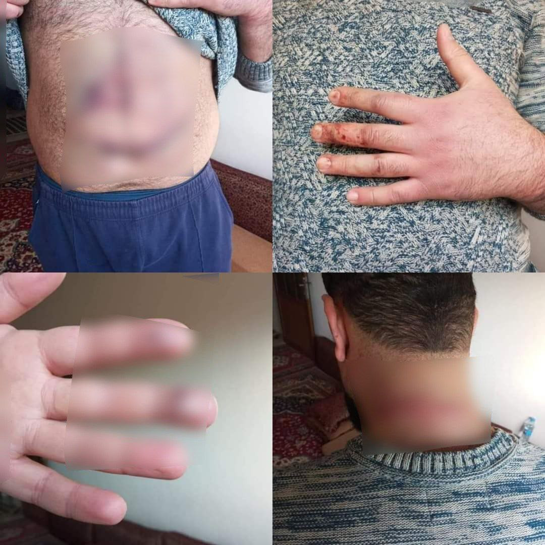 "قسد" تختطف ناشطا إعلاميا وتعذ...