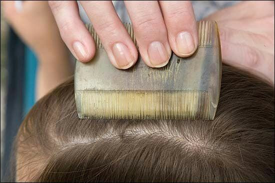 مديرة الصحة بدمشق تبرر "انتشار...