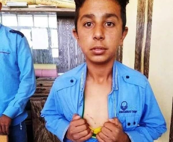 طفلان يقتلان ذئبا حاول افتراس...