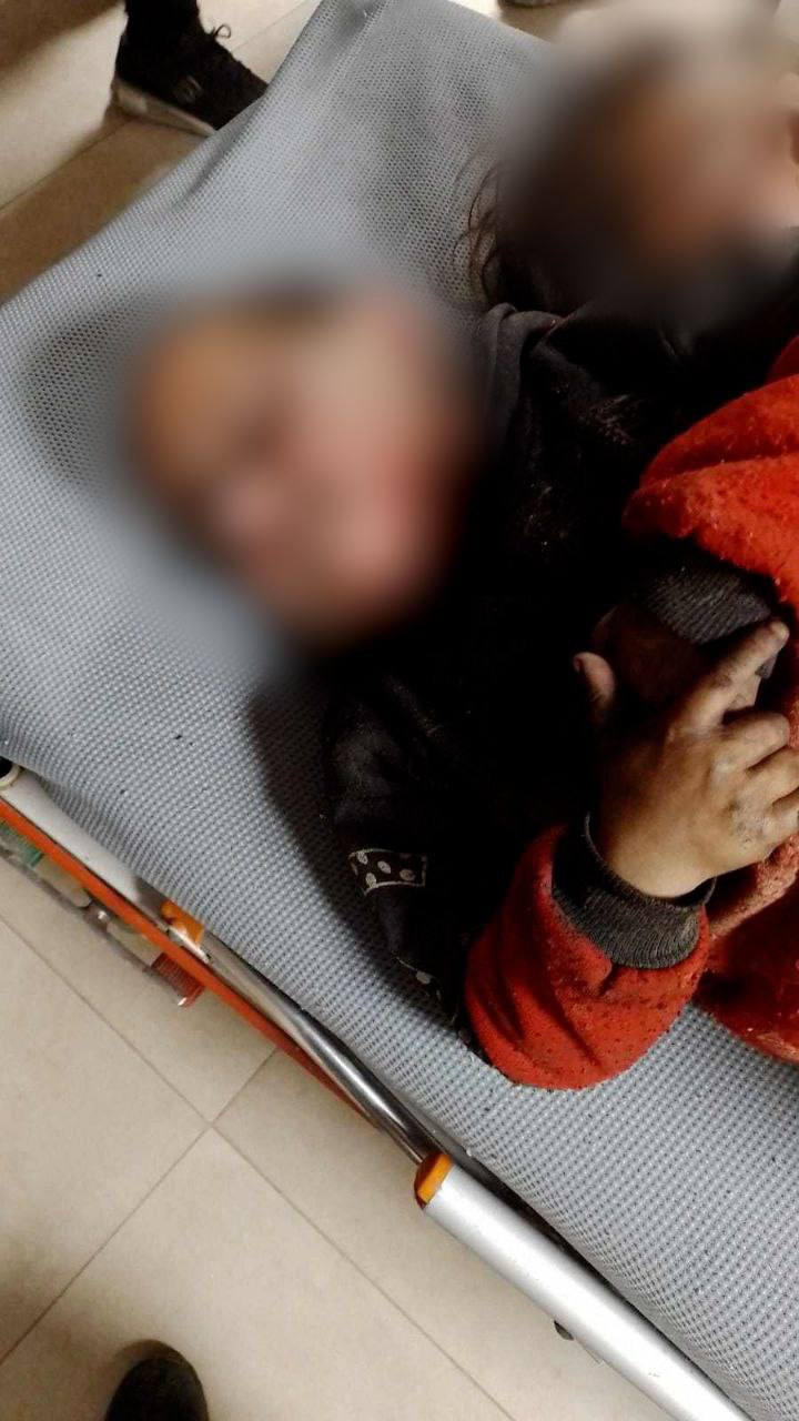 حلب.. مقتـل طفل وإصابة أشقائه...