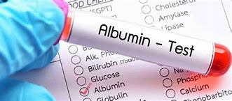 الموالون بين شح الأدوية و غلاء...