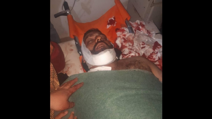 مجهولون يغتالون قياديا سابقا ب...