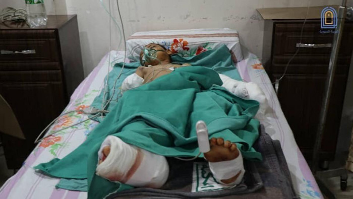 إصابة طفلين بانفجار لغم بالحسك...