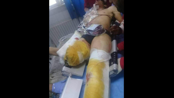 استشهاد مدني بانفجار لغم والنظ...