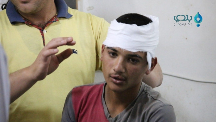 جرحى مدنيون بانفجار لغم من مخل...