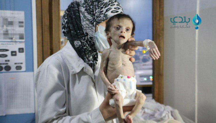 "العليا للمفاوضات": حصار النظا...