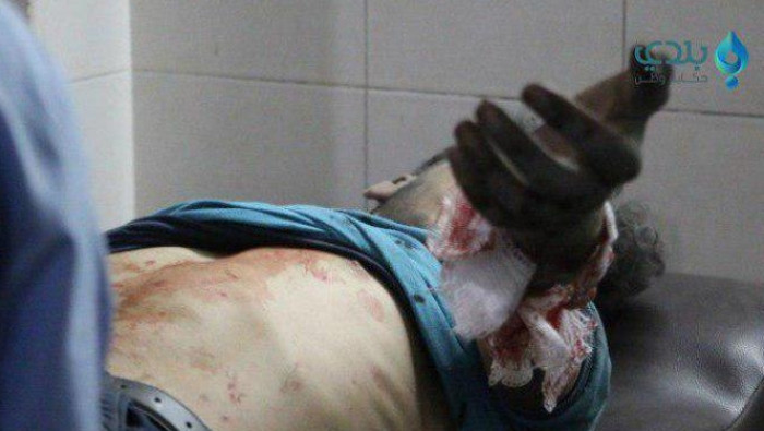 ارتفاع حصيلة شهداء الغوطة الشر...