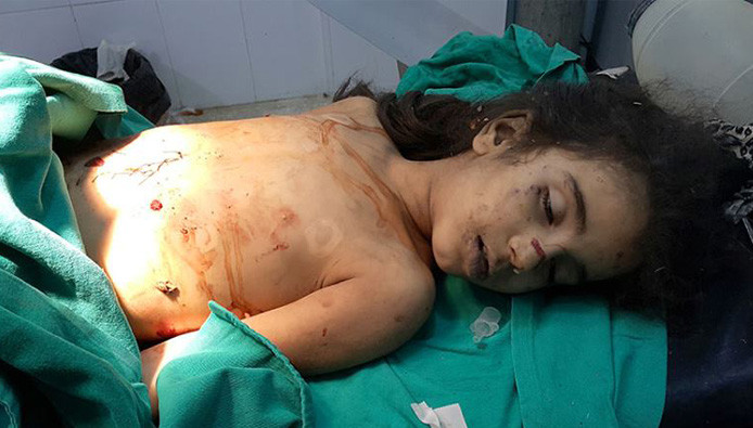 عشرات الشهداء والجرحى.. طيران...