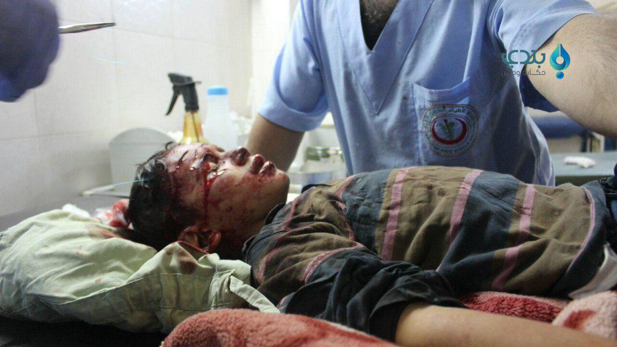 ثلاثة شهداء وجرحى بقصف النظام...