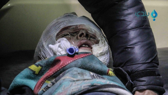 أربعة شهداء بقصف بقنابل النابا...