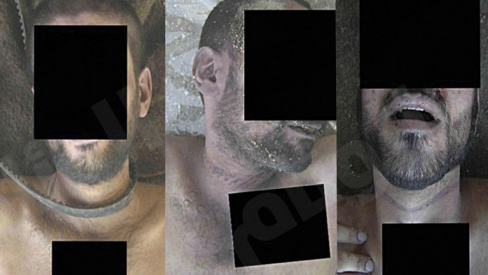 الكشف عن حصيلة ضحايا التعذيب م...