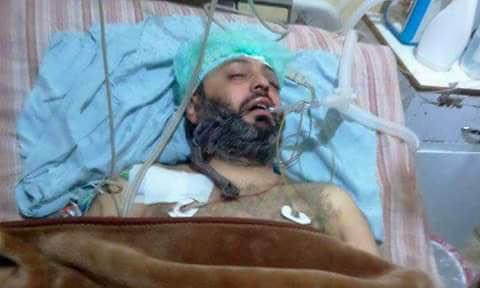 غوطة دمشق تدفن طبيبها الأخير