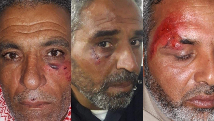 "ب ي د" يعتقل ثلاثة مدنيين ويع...