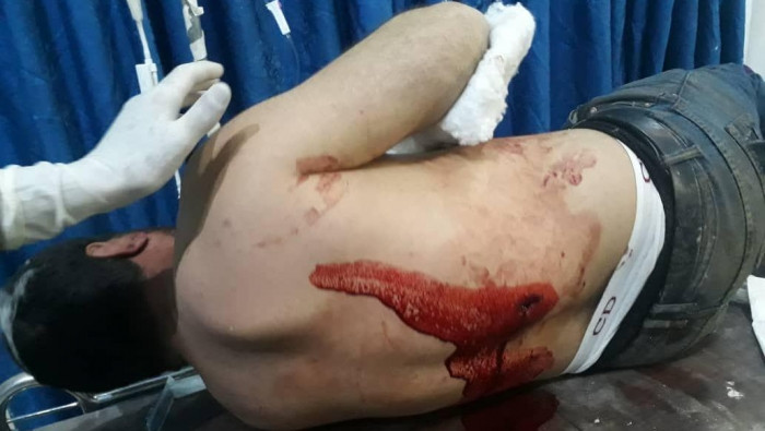 امرأة شهيدة وجرحى بقصف للنظام...