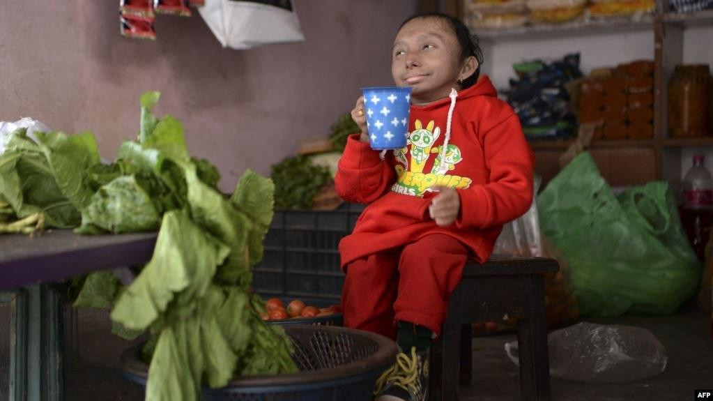 دخل موسوعة غينيس بطول 67 سم..‏...