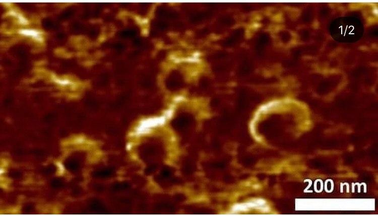 صورة عالية الدقة لفيروس "كورون...