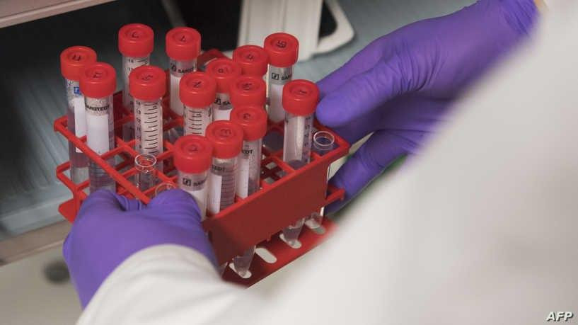 دراسة: 75% من المصابين بـ "كور...