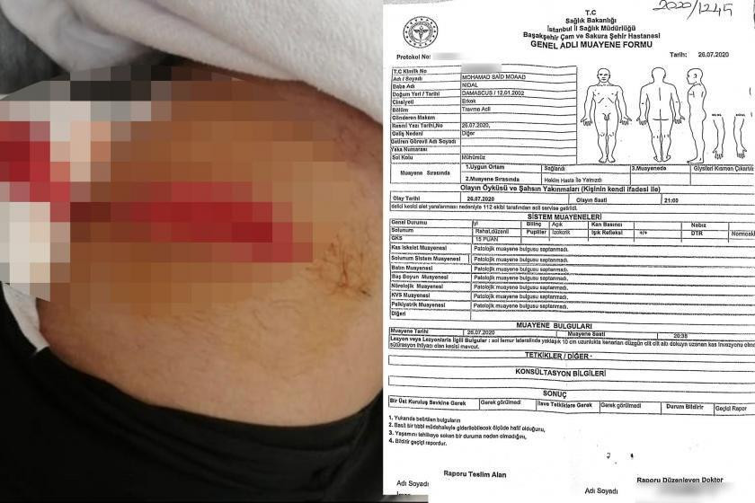 اعتداء جديد.. شاب سوري يتعرض ل...