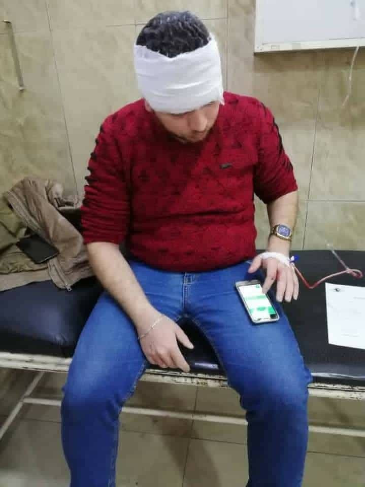 مجهولون يهاجمون مراسل وكالة "س...