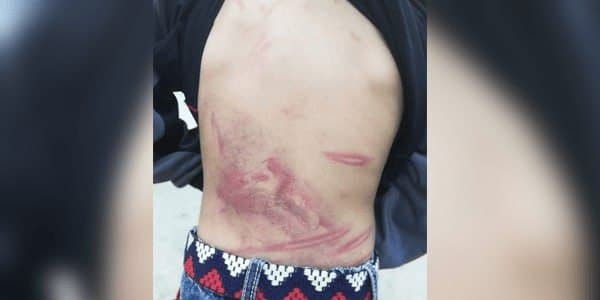 لاجئ سوري يكسر فك طفله لانزعاج...