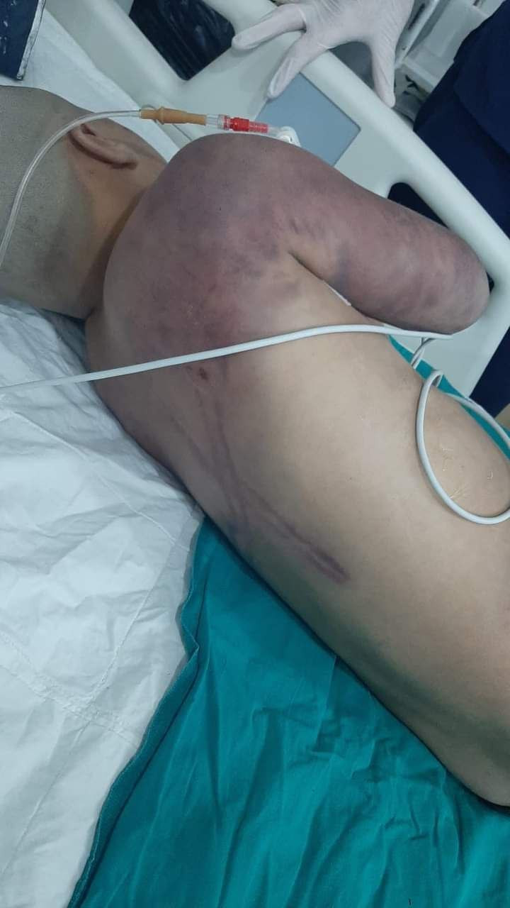 طبيب بمستشفى "باب الهوى" يكشف...