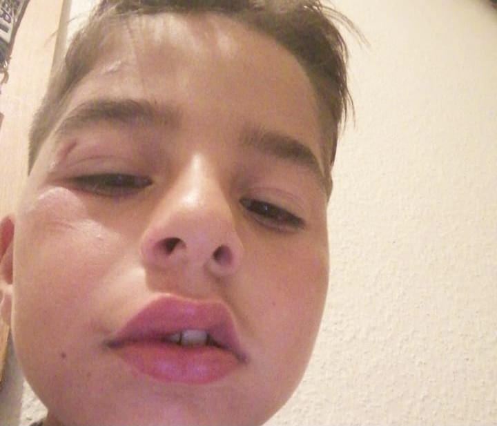 اعتـ.ـداء عنـ.ـصري على طفل سور...