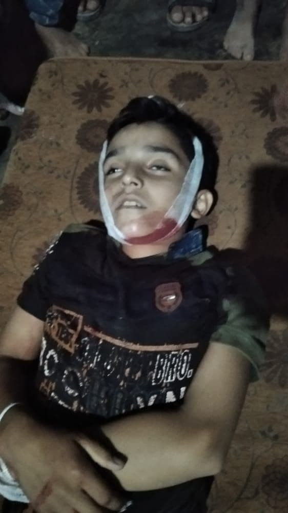 مقتل طفل برصاص الجندرمة التركي...