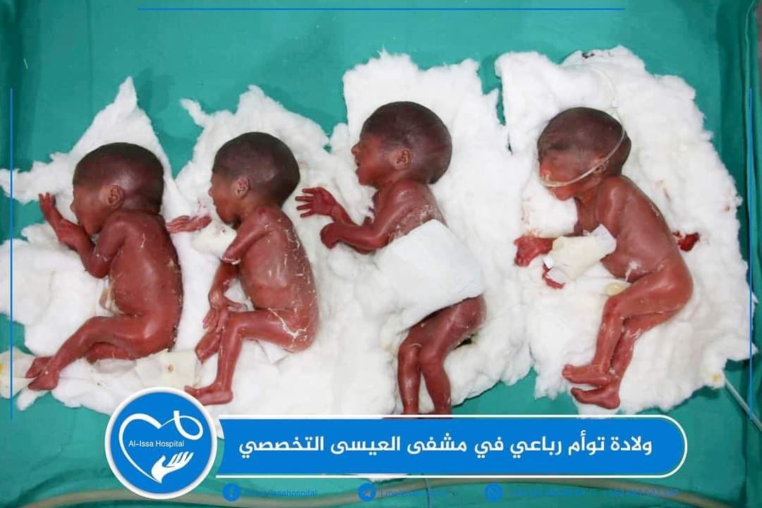 ولادة أربعة توائم في إدلب