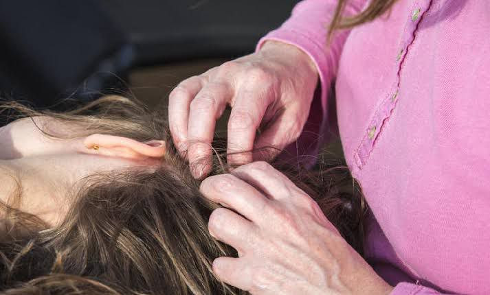 ارتفاع الإصابات بالجرب والقمل...