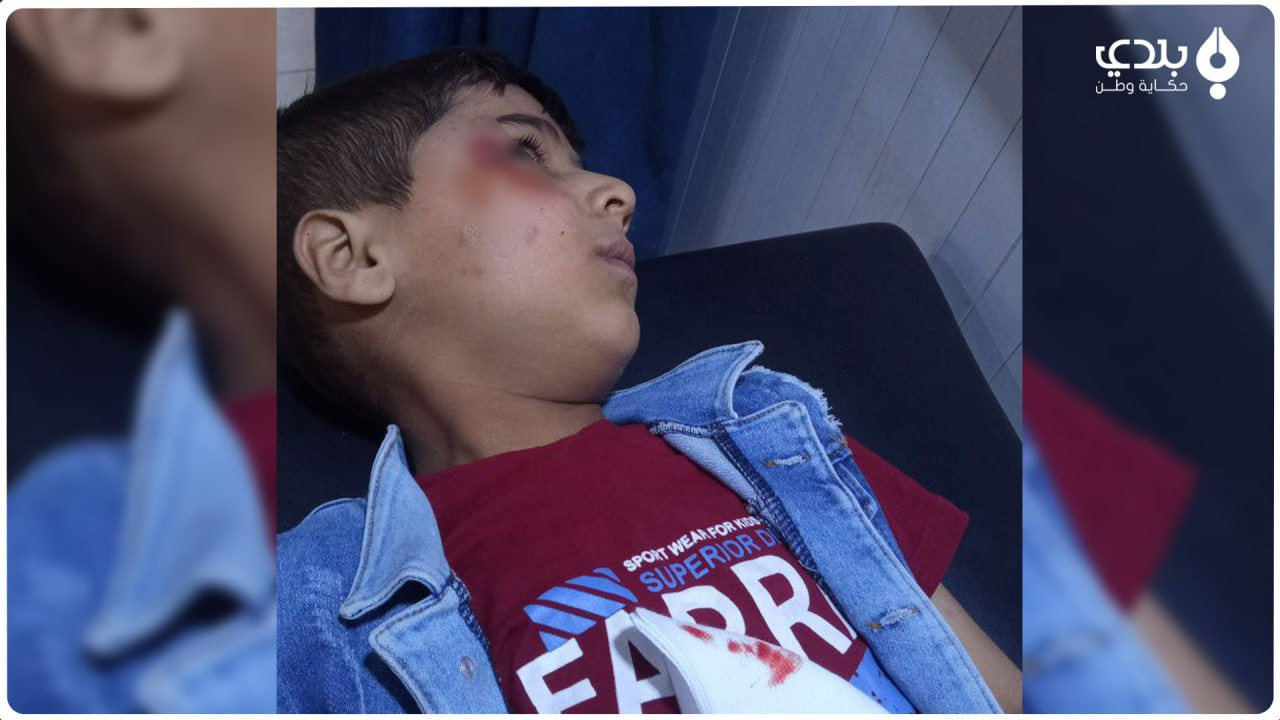 إصابات في صفوف الأطفال في عفري...