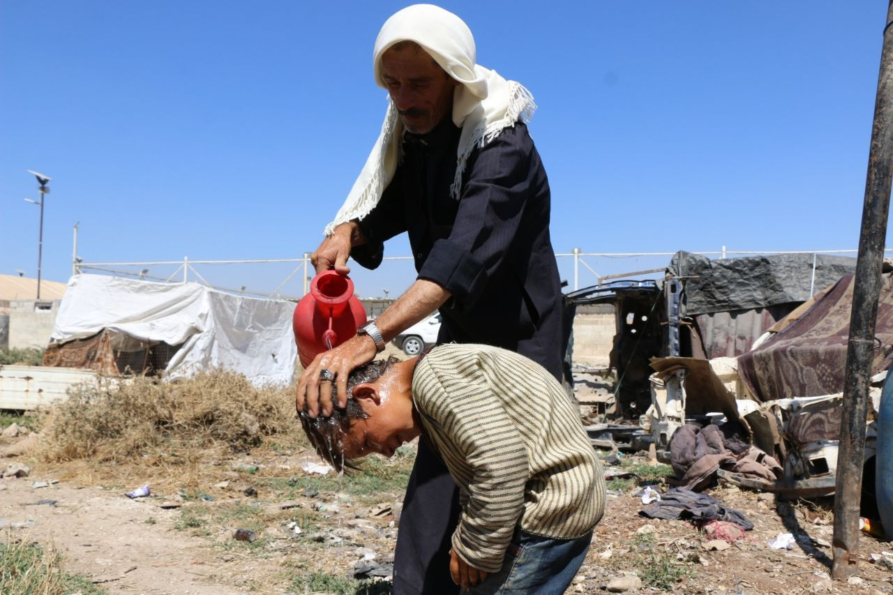 وفاة طفلة بمرض الكوليرا في بلد...