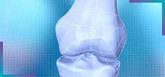 تبديل المفصل يصل عتبة 70  مليو...