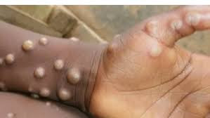 بمَ طالب المدير الإقليمي لمنظم...